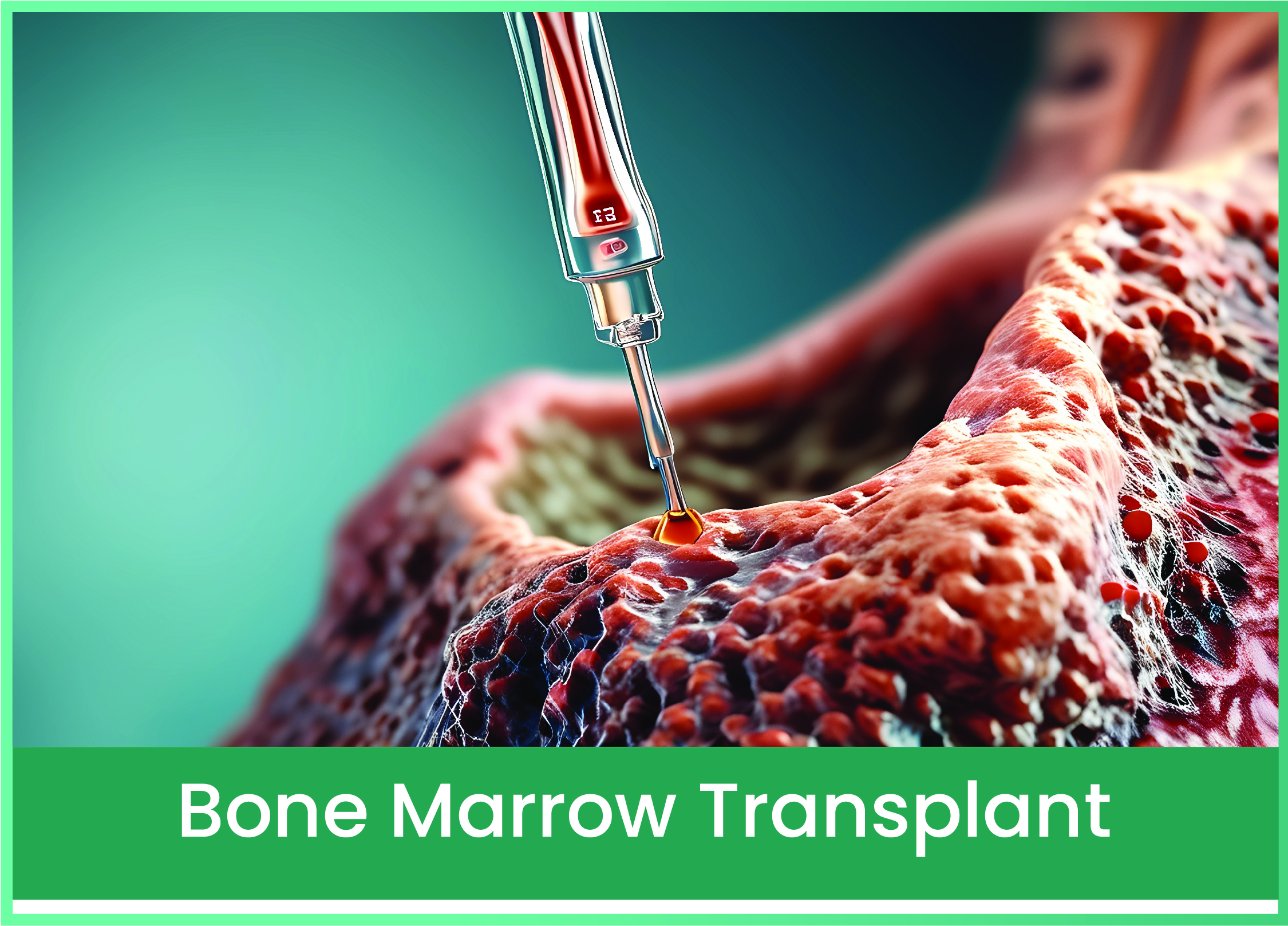 BoneMarrowTransplantExplained